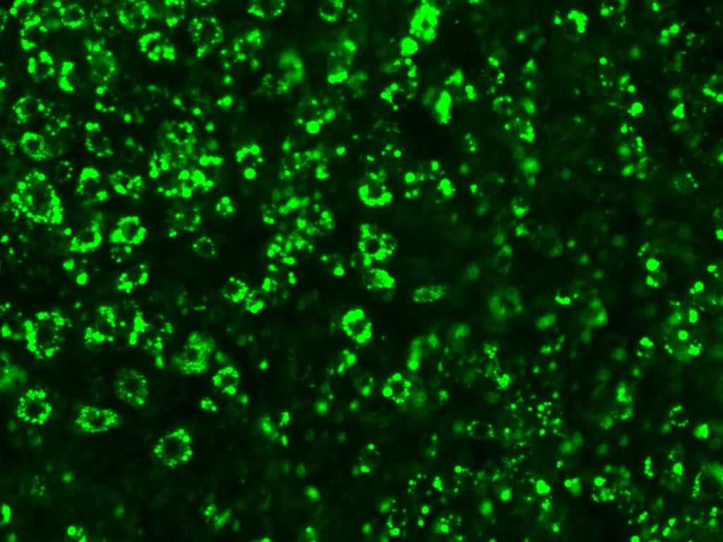 Microproteínas identificadas nos EUA abrem caminho para medicamentos inéditos contra obesidade - Imagem do artigo original
